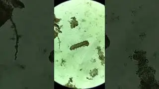 Pink Mold under the microscope!