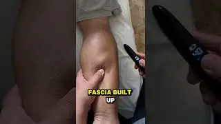 Узел в икре?