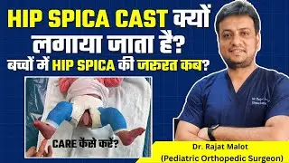 Hip Spica Cast क्या है? कब और क्यों लगाया जाता है? | Dr. Rajat Malot