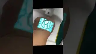 7 Color Fit Any Skin | Vein Finder With Table Stand | AIMVEIN