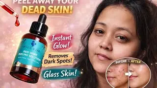 &ldquo;Peeling Solution ka REAL TEST | Honest Review&rdquo;#pilgrim #peelingsolution #viralvideos #realresults 