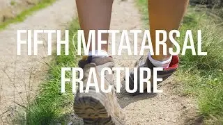 Fifth metatarsal fracture: Treatment options depending on the location of injury