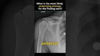 Medical Unknown Case! What's the diagnosis?