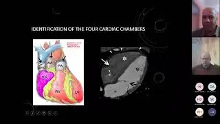16.Cases discussion of Cardiac CT by Dr.Ragab Hani & Genitourinary cases by Dr.Tarek El-diasty.
