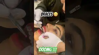 Braces experts in multan | orthodontist in multan best dentist for braces in multan