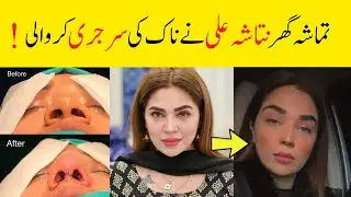 Natasha Ali Nose Surgery video Viral!