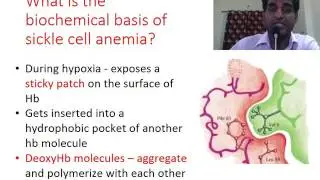 3-minute lesson - Biochemistry: Biochemical basis of sickle cell disease