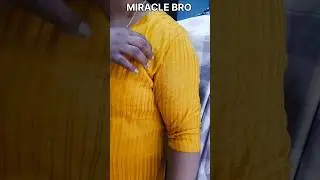 alteration