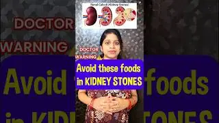 #kidneystone #shorts #youtubeshorts #food #diet #healthtips #doctor