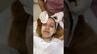 Fractional Laser Treatment At Dr. Haror's Wellness  #loveyourself #drharorswellness #shorts