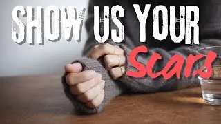 Show Us Your Scars