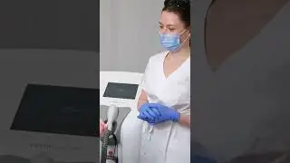 ALEX 755 эпиляция самая эффективная. Сморим полное видео 🤗 #coccon #cocoonmedical #эпиляция