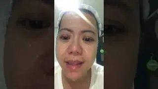 Calamine 30 days secret toner review (1st day)