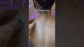 Get Rid Of Dark Skin | Neck Cleaning Tips | Remove Skin Tan #darkskin #neck #neckcleaning #shorts