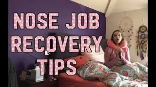 NOSE JOB RECOVERY TIPS & TRICKS | m & j