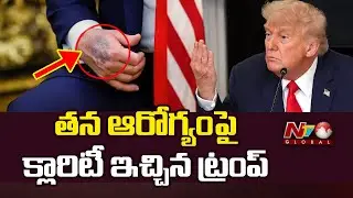 Trump Responds to Hand Bruise Speculation, Denies Health Issues | NTV Global