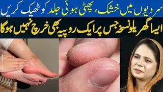 Skin Falling in Winters | Natural Cure for Full Body Dryness | Free Home Remedy | Malida Recipe