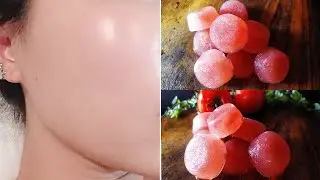 Use 1 tomato ice cube daily see what the result | reduce open pores | glass Skin | Skin Whitening