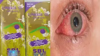 EUPHRASIA EYE DROPS  |  यूफ्रेसिया आंख का ड्रॉप हिंदी में  | EUPHRASIA EYE DROPS IN HINDI