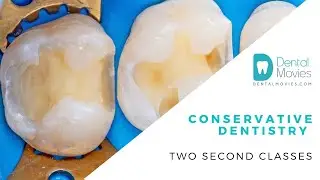 Conservative dentistry - two second classes