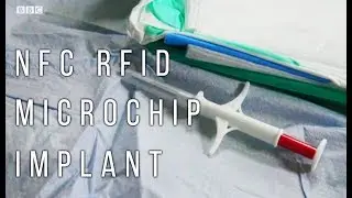 BBC Inside Out | Microchip Implant Uses