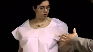9 Months Post Nerve Transplant Testimonial