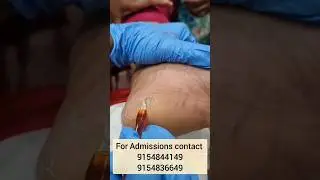 Pedicure tip| Skin care | Orane International Hyderabad