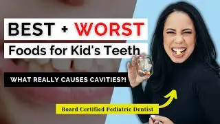 5 Best + Worst Foods for Kid&rsquo;s Teeth | How to Avoid Cavities + Bonus Dentist Approved Snack Ideas