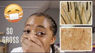 MAKEUP VS NO MAKEUP Under a Microscope