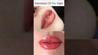 Coconut Oil For Lips  #Soft Pink Lips #Home Remedy   Beauty Tips#ytshorts #trending