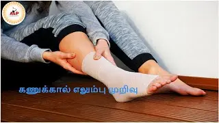 கணுக்கால் எலும்பு முறிவு ஏன் ? #alp #astrology #ankle #bone #fracture #alpastrology #prediction