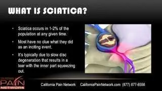 What are the Indications for Surgery with Sciatica? (310) 626-1526