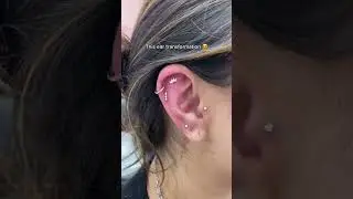 Our client ear transformation 😍