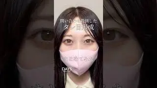 【目元整形】人気のタレ目形成まとめてみました！#shorts