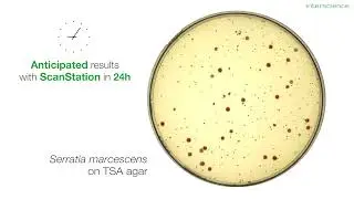 Interscience scanstation: real time incubator and colony counter