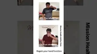 Hand Function Before & After Occupational Therapy In India @ Mission Health | Medical Tourism