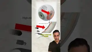 This bionic eye turns camera vision into brain signals!  With gene therapy and a retinal implant, th