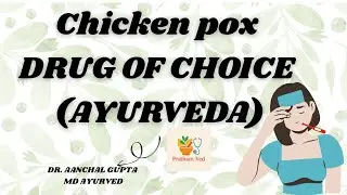 Chickenpox treatment at home | with personal experience 