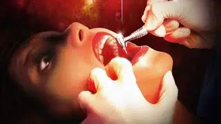 The Dentist (1996) - Trailer HD 1080p