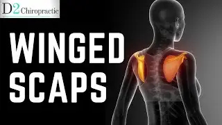 Winging Scapulae : Serratus Anterior & Lower Trap Strengthening