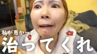 肌荒れで動画休んでたらニキビの原因分かったわ…寝支度しながら話す