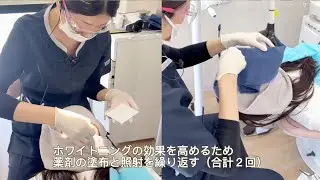 ホワイトニングのご案内🦷【堺市 なかもず駅前 なかもずファミリー歯科】