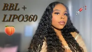 I&rsquo;m getting a BBL + LIPO 360 | Mia Aesthetics | Dr Chua | MY JOURNEY