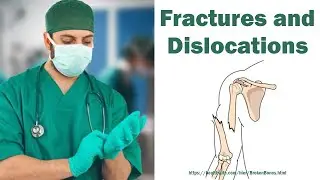Fractures and Dislocations | The Surgeon - Dr Hesham Wageh