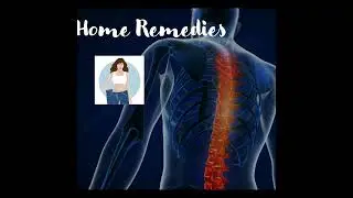 Back Pain | MedCentral | Checkout the Link in Description