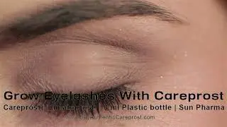 Careprost for hair  | Buy Authentic Careprost | #careprost