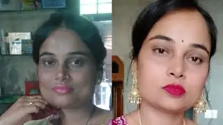 My Pigmentation Healing Journey | Diet, Skin Care & Real Results