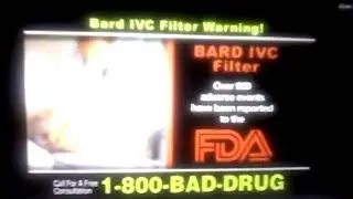 PULASKI & MIDDLEMAN L.L.C ATTORNEY TV COMMERCIAL FOR BARD IVC FILTERS - ISPOT.TV