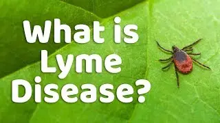 Fatigue, Chronic Pain, Unexplained Health Issues: Could it be Lyme Disease? Fibromyalgia, Anxiety