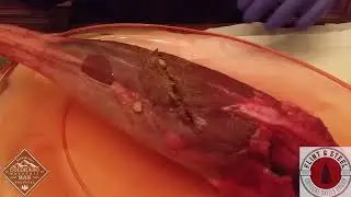 Wound Cleaning and Closure in the Backcountry